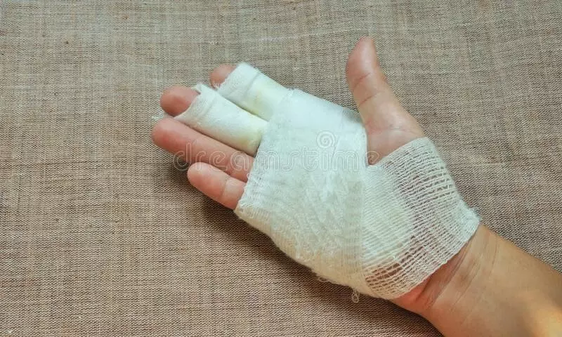 ഭര്‍ത്താവുമായി അടുപ്പമുണ്ടെന്ന സംശയത്തിൽ   സ്ത്രീകള്‍ തമ്മിൽ കത്തിക്കുത്ത്​; യുവതിക്ക്​ പരിക്ക്​