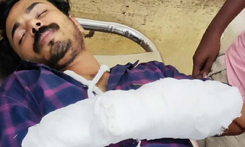 കോളജിൽ സംഘർഷം: എസ്.എഫ്.​െഎ ഏരിയ സെക്രട്ടറിക്ക് വെട്ടേറ്റു