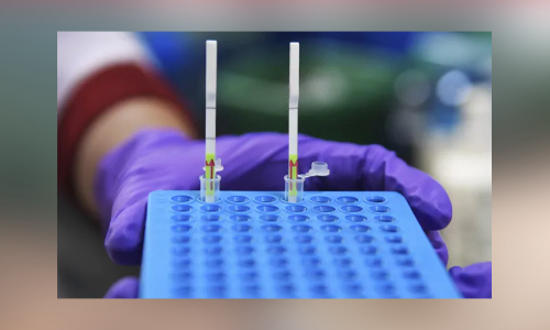 സംസ്ഥാനത്ത് ഇന്ന് 7955 പേര്‍ക്ക് കോവിഡ്;  57 മരണം