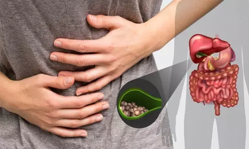 പിത്താശയ കല്ല്: ലക്ഷണങ്ങൾ, തടയാൻ ചെയ്യേണ്ടത്...