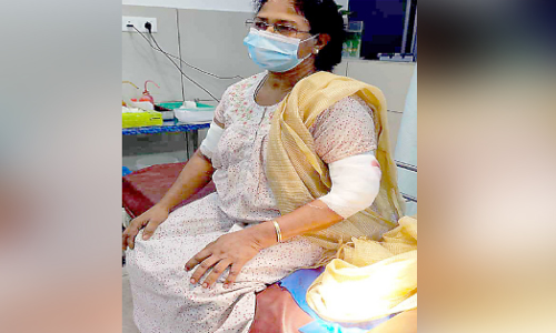 പുലിയുടെ ആക്രമണത്തിൽ വീട്ടമ്മക്ക് പരിക്ക്