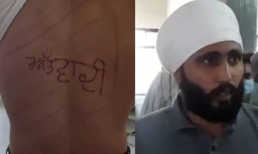 തടവുകാരന്റെ ദേഹത്ത് ജയിൽ സൂപ്രണ്ട് തീവ്രവാദിഎന്ന് ചാപ്പകുത്തി; അന്വേഷണം പ്രഖ്യാപിച്ചു തടവുകാരന്റെ ദേഹത്ത് ജയിൽ സൂപ്രണ്ട് തീവ്രവാദിഎന്ന് ചാപ്പകുത്തി; അന്വേഷണം പ്രഖ്യാപിച്ചു