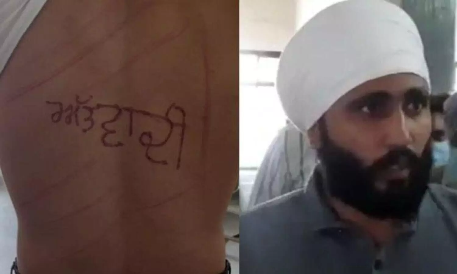 തടവുകാരന്‍റെ ദേഹത്ത്​ ജയിൽ സൂപ്രണ്ട്​ തീവ്രവാദിഎന്ന് ചാപ്പകുത്തി; അന്വേഷണം പ്രഖ്യാപിച്ചു