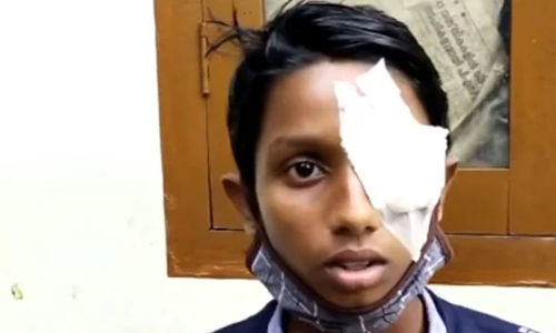 അയൽവാസിയുടെ ക്രൂരത; കു​ട്ടി​ക​ളെ ക​ളി​ക്കാ​ന്‍ വി​ളി​ച്ചതിന്​ പത്താംക്ലാസുകാരന്‍റെ കണ്ണ്​ അടിച്ച്​ തകർത്തു