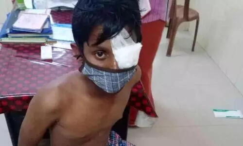 കളി തടസപ്പെടുത്തിയത് ചോദ്യം ചെയ്ത 15കാരന് മധ്യവയസ്കന്‍റെ മർദനം