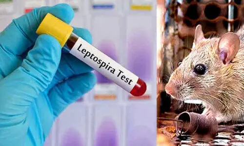 എ​ലി​പ്പ​നിക്കെതിരെ ജാ​ഗ്ര​ത വേ​ണം