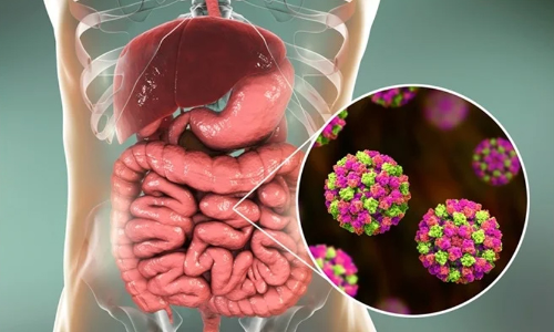 നോറോ വൈറസ് ലക്ഷണങ്ങളും പ്രതിരോധ മാർഗങ്ങളും അറിയാം; കേരളത്തിൽ​ രോഗം സ്ഥിരീകരിച്ചു