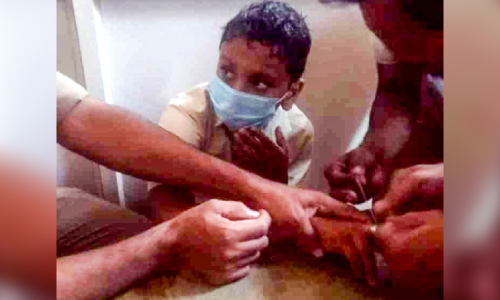 സ്​റ്റീൽ മോതിരങ്ങൾ അപകടകാരികൾ; ജാഗ്രതവേണമെന്ന് അധികൃതർ