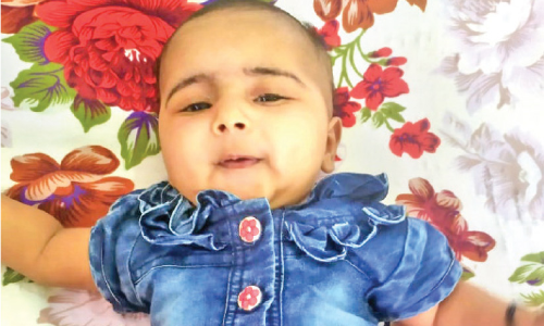 വേണം 18 കോടി; ഈ പി​േഞ്ചാമനയ​ുടെ പുഞ്ചിരി മായാതിരിക്കാൻ