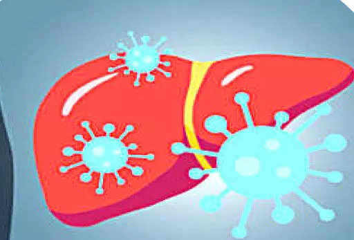 Hepatitis C Hepatitis C