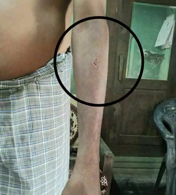 മലയിൻകീഴിൽ പേപ്പട്ടിയുടെ ആക്രമണം; നിരവധി പേർക്ക് കടിയേറ്റു മലയിൻകീഴിൽ പേപ്പട്ടിയുടെ ആക്രമണം; നിരവധി പേർക്ക് കടിയേറ്റു