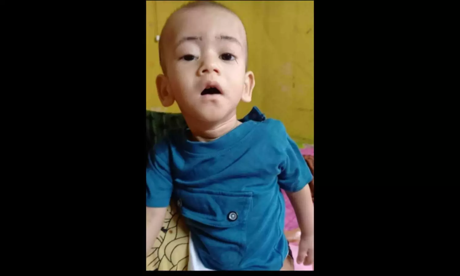 മജ്ജ മാറ്റണം, ഈ ഒരു വയസുകാരന് ജീവൻ നിലനിർത്താൻ