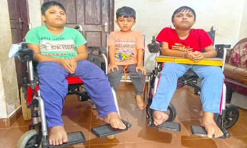 Spinal Muscular Atrophy (SMA)