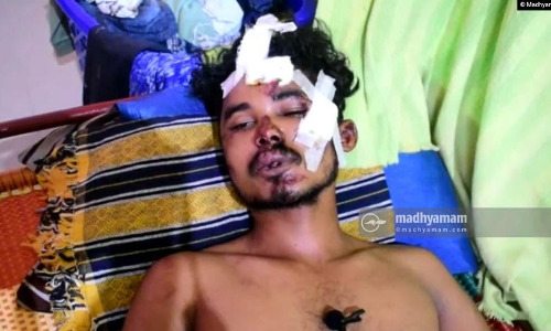 യുവാവിനെ മർദിച്ച പ്രതിക്ക്​ ജാമ്യം നൽകിയത്​ വിവാദത്തിൽ