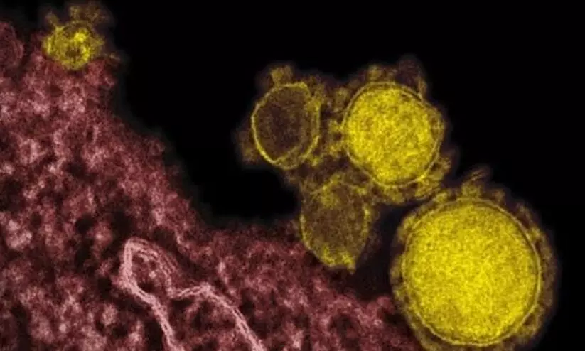 വിവിധ സാംക്രമിക രോഗങ്ങൾ, ലക്ഷണം, ചികിത്സ, പ്രതിരോധം വിവിധ സാംക്രമിക രോഗങ്ങൾ, ലക്ഷണം, ചികിത്സ, പ്രതിരോധം