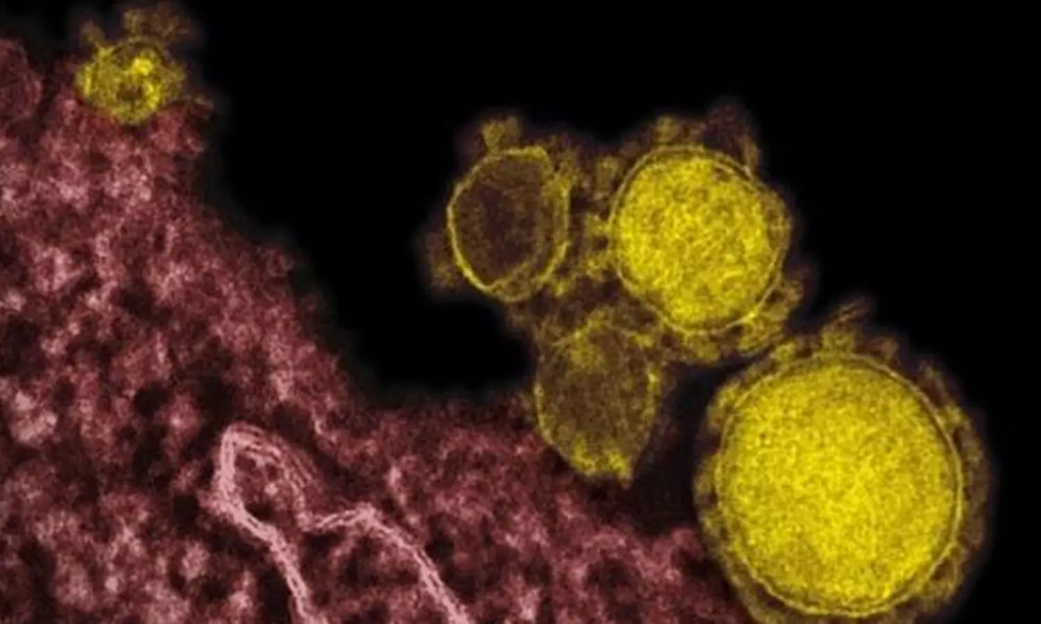 വിവിധ സാംക്രമിക രോഗങ്ങൾ, ലക്ഷണം, ചികിത്സ, പ്രതിരോധം