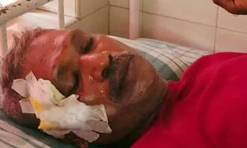 ഫസൽ വധത്തിലെ സി.പി.എം പങ്ക് പുറത്തുകൊണ്ടുവന്ന മുൻ ഐ.പി.എസ് ഉദ്യോഗസ്ഥന് വാഹനാപകടത്തിൽ പരിക്ക്