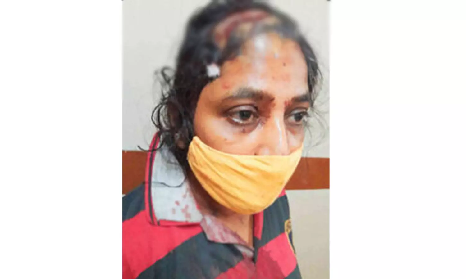 പയ്യോളിയിൽ വീട്ടുപറമ്പിലൂടെ അനധികൃതമായി റോഡ് നിർമ്മിക്കുന്നത് തടയാൻ ശ്രമിച്ച യുവതിക്ക്  ക്രൂരമർദനം