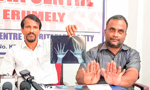 24 വിരലുകളും ചലിപ്പിക്കാം: വിനേഷിന് ഇന്ത്യൻ ബുക്ക് ഓഫ് റെക്കോഡ്‌സ്