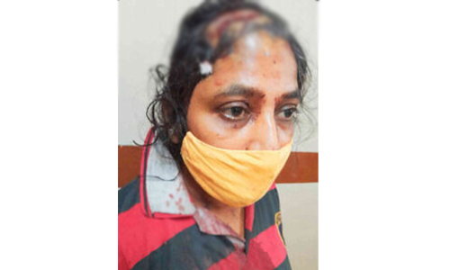 പയ്യോളിയിൽ വീട്ടുപറമ്പിലൂടെ അനധികൃതമായി റോഡ് നിർമ്മിക്കുന്നത് തടയാൻ ശ്രമിച്ച യുവതിക്ക് ക്രൂരമർദനം പയ്യോളിയിൽ വീട്ടുപറമ്പിലൂടെ അനധികൃതമായി റോഡ് നിർമ്മിക്കുന്നത് തടയാൻ ശ്രമിച്ച യുവതിക്ക് ക്രൂരമർദനം