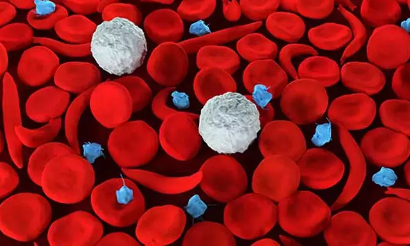 sickle cell anemia in kerala sickle cell anemia in kerala