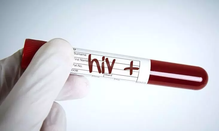 HIV positive