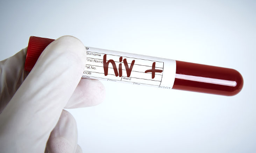 ഇന്ന്​ ലോ​ക എ​യ്ഡ്‌​സ് ദി​ന​ം; 2025 ഓടെ പുതിയ എച്ച്.ഐ.വി അണുബാധ ഇല്ലാതാക്കുക ലക്ഷ്യം –മന്ത്രി