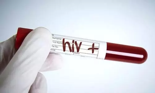 HIV positive