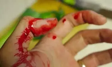 ഭർത്താവിന്​ ഭക്ഷണത്തിൽ ആർത്തവ രക്​തം കലർത്തി നൽകി; അന്വേഷണത്തിന്​ പ്രത്യേക മെഡിക്കൽ ബോർഡ്​