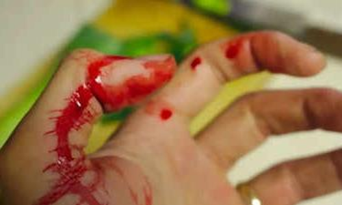 ഭർത്താവിന്​ ഭക്ഷണത്തിൽ ആർത്തവ രക്​തം കലർത്തി നൽകി; അന്വേഷണത്തിന്​ പ്രത്യേക മെഡിക്കൽ ബോർഡ്​