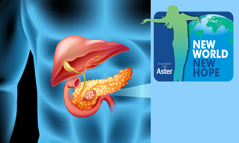 പാൻക്രിയാറ്റിക് കാൻസർ: ലക്ഷണങ്ങൾ ശ്രദ്ധിക്കണം പാൻക്രിയാറ്റിക് കാൻസർ: ലക്ഷണങ്ങൾ ശ്രദ്ധിക്കണം