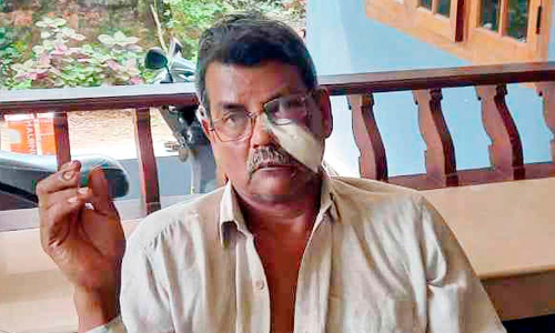 കടം നൽകിയ പണം തിരികെ ചോദിച്ചതിന് വെട്ടിപ്പരിക്കേൽപിച്ചതായി പരാതി