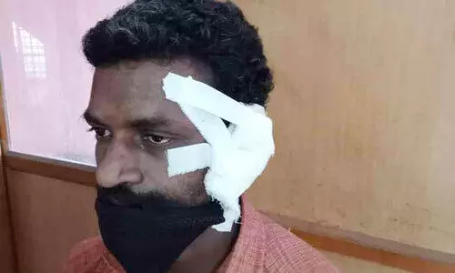 പരാതിക്കാരനായ ദലിത് യുവാവിനെ പ്ര​തി​ക​ൾ​ക്കൊ​പ്പം ലോ​ക്ക​പ്പി​ൽ നി​ർ​ത്തി കൊ​ട്ടാ​ര​ക്ക​ര സി.ഐ