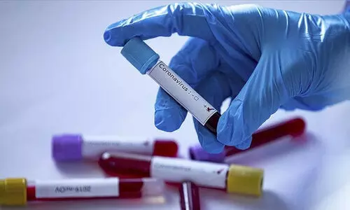 ഒ​മി​ക്രോ​ൺ സ്ഥി​രീ​ക​രി​ച്ച ദ​ക്ഷി​ണാ​ഫ്രി​ക്ക​ൻ പൗ​ര​ൻ രാ​ജ്യം വി​ട്ട സം​ഭ​വ​ത്തി​ൽ അ​ന്വേ​ഷ​ണം