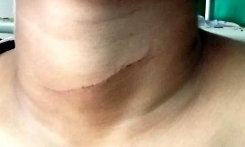 പതിനൊന്നുകാരന് അയല്വാസിയുടെ കുത്തേറ്റു പതിനൊന്നുകാരന് അയല്വാസിയുടെ കുത്തേറ്റു