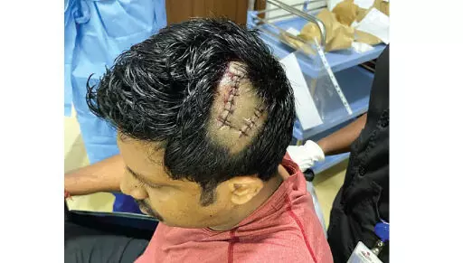 പ്രണയവിവാഹത്തിന് പിന്തുണ നൽകിയതിന് യുവാവിനെ വധിക്കാൻ ശ്രമം