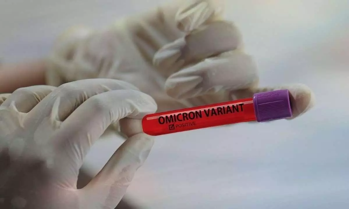 Molecular Diagnosis Test Can Detect Omicron Variant In 20 Minutes Molecular Diagnosis Test Can Detect Omicron Variant In 20 Minutes