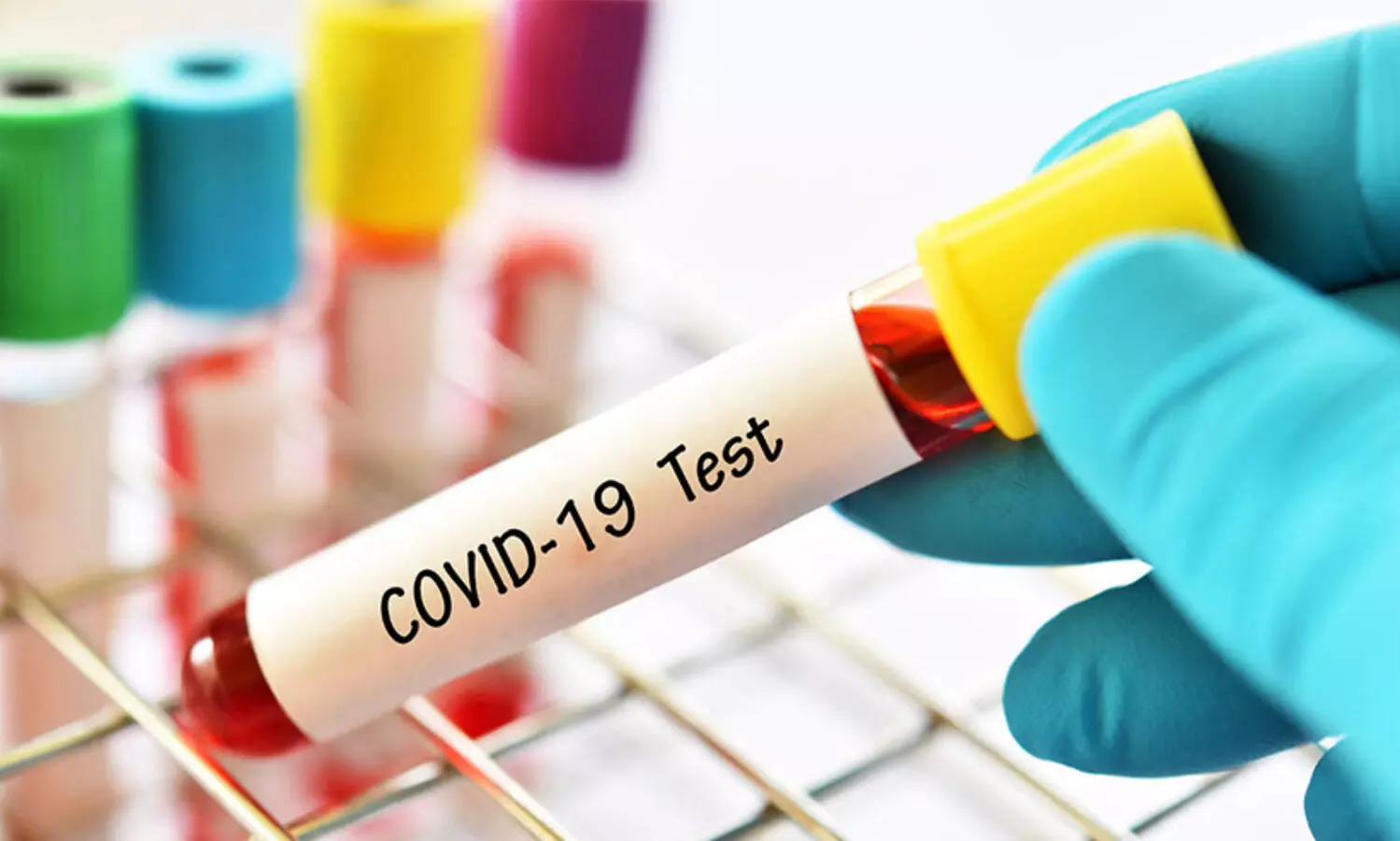 35 പേ​ർ​ക്ക്​ കോ​വി​ഡ്​; 30 പേ​ർ​ക്ക്​ വി​മു​ക്തി