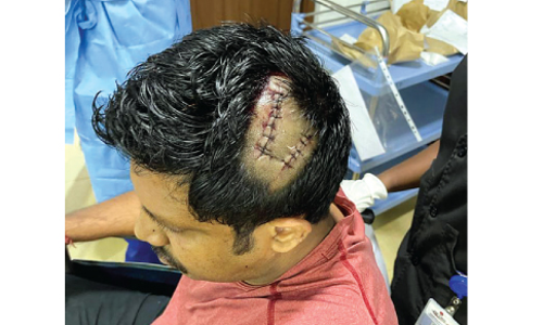 പ്രണയവിവാഹത്തിന് പിന്തുണ നൽകിയതിന് യുവാവിനെ വധിക്കാൻ ശ്രമം