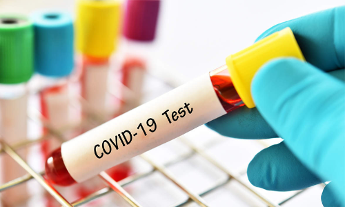 35 പേ​ർ​ക്ക്​ കോ​വി​ഡ്​; 30 പേ​ർ​ക്ക്​ വി​മു​ക്തി