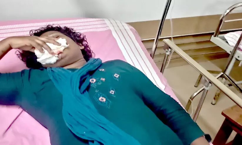 ബിന്ദു അമ്മിണിയെ ഓ​ട്ടോയിടിച്ച്​ അപകടപ്പെടുത്താൻ ശ്രമം