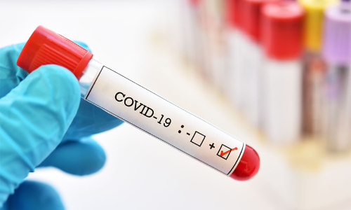 കോ​വി​ഡ്​: 177 പേ​ർ​ക്ക്​ രോ​ഗ​ബാ​ധ