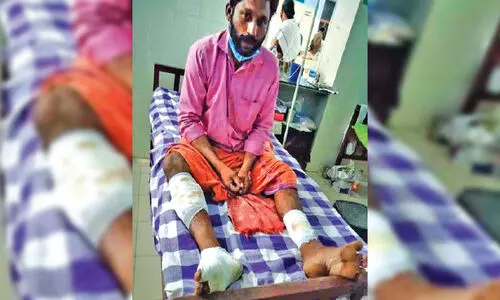 തെരുവുനായ്ക്കളുടെ കടിയേറ്റ് മത്സ്യത്തൊഴിലാളിക്ക് പരിക്ക്