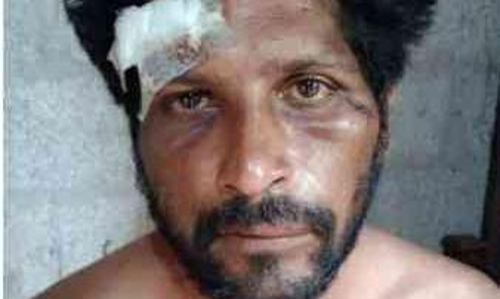 യുവാവിനെ സംഘം ചേർന്ന് മർദിച്ചതായി പരാതി