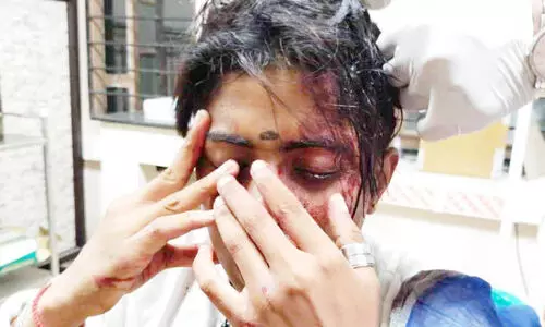 ശ്രീകാര്യത്ത് ട്രാൻസ്ജെൻഡറെ തലക്കടിച്ച് പരിക്കേൽപ്പിച്ചു