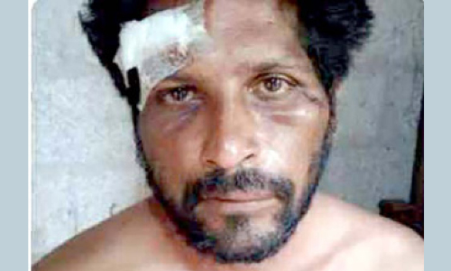 തുറിച്ചുനോക്കിയെന്നാരോപിച്ച്​ യുവാവിനും ഭാര്യക്കും മർദനം