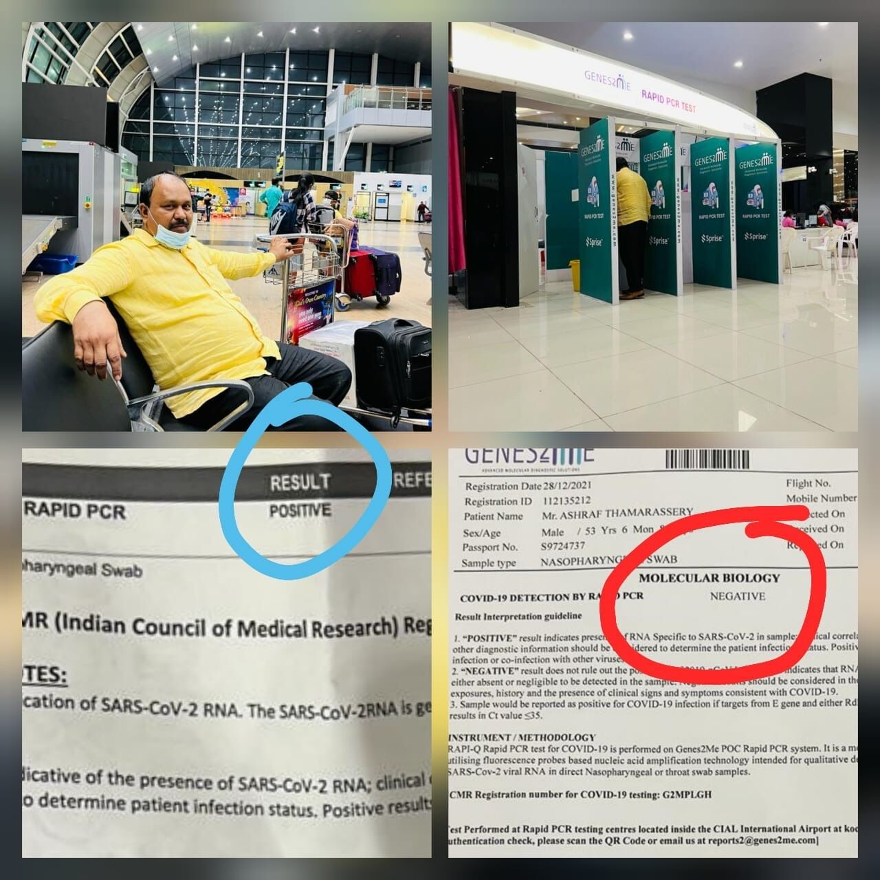 തിരുവനന്തപുരത്ത്​ പോസിറ്റീവ്​; നെടുമ്പാശേരിയിൽ നെഗറ്റീവ്; വിമാനത്താവളങ്ങളിലെ കോവിഡ്​ ഫലം മാറി മറിഞ്ഞത്​ വിവരിച്ച്​ അഷ്​റഫ്​ താമരശേരി