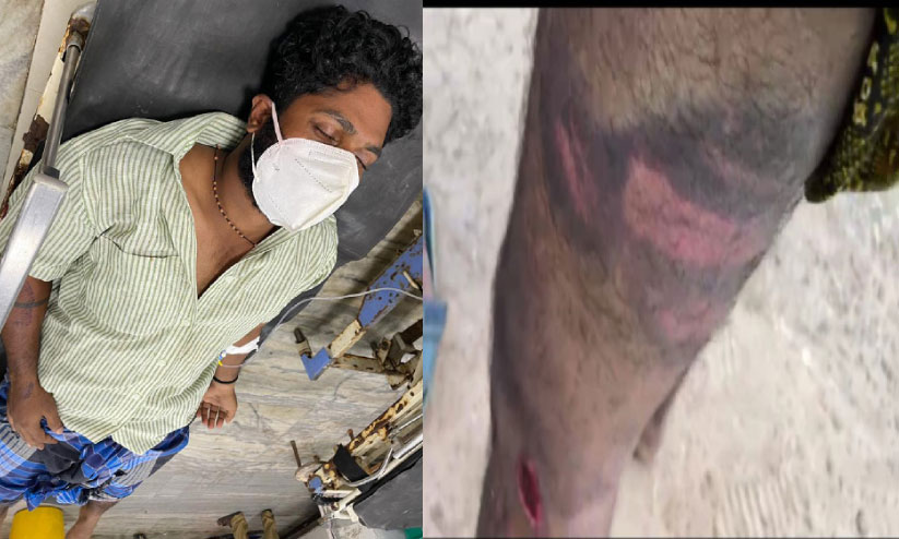 കർഫ്യൂവിനിടെ യുവാവിന് പൊലീസിന്റെ ക്രൂരമർദനം കർഫ്യൂവിനിടെ യുവാവിന് പൊലീസിന്റെ ക്രൂരമർദനം