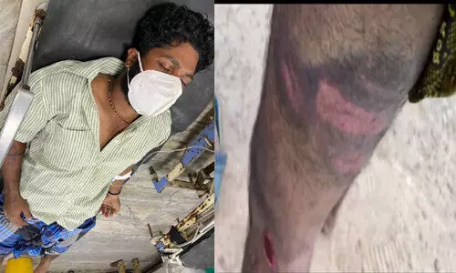 ക​ർ​ഫ്യൂവിനിടെ യുവാവിന്​ പൊലീസിന്‍റെ ക്രൂരമർദനം