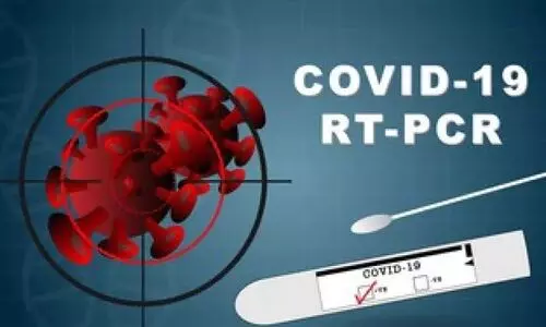 പി.​സി.​ആ​ർ സ​മ​യ​പ​രി​ധി 72 മ​ണി​ക്കൂ​റാ​ക്കി